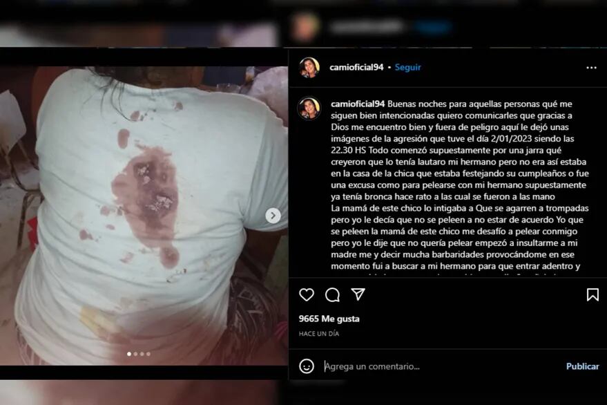 Camila Medina llevó tranquilidad a sus seguidores tras la agresión recibida. Foto: Instagram/@camioficial94