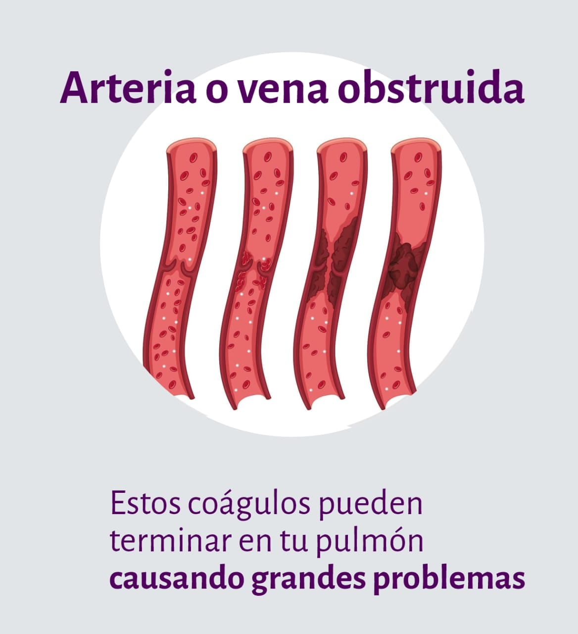 13 de Octubre: Día Mundial de la Trombosis