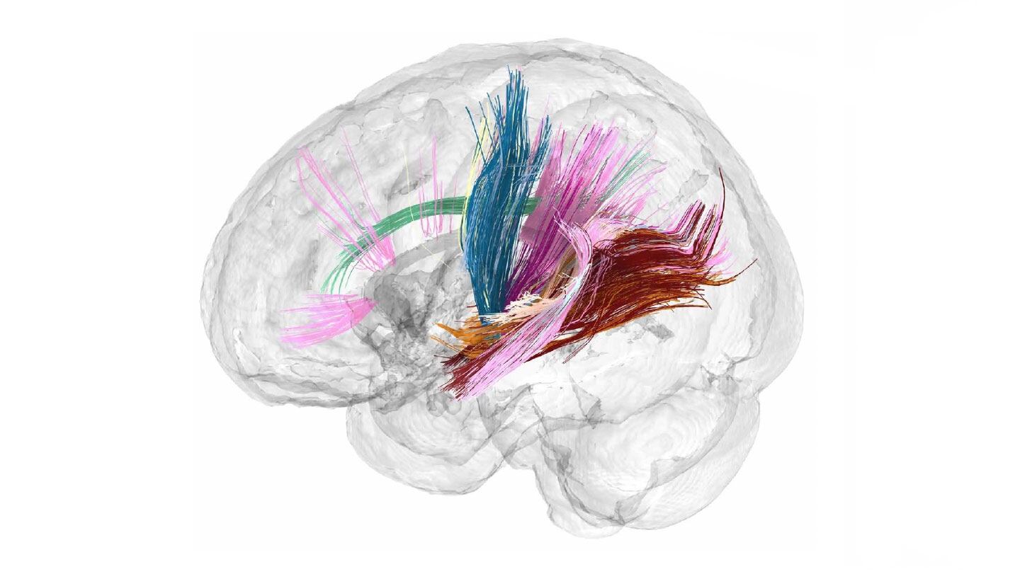 cerebro mujer embarazada