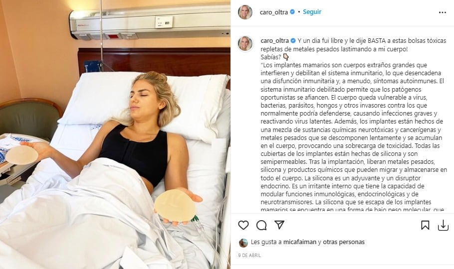 Carolina Oltra mostró su antes y después de la cirugía de implantes mamarios