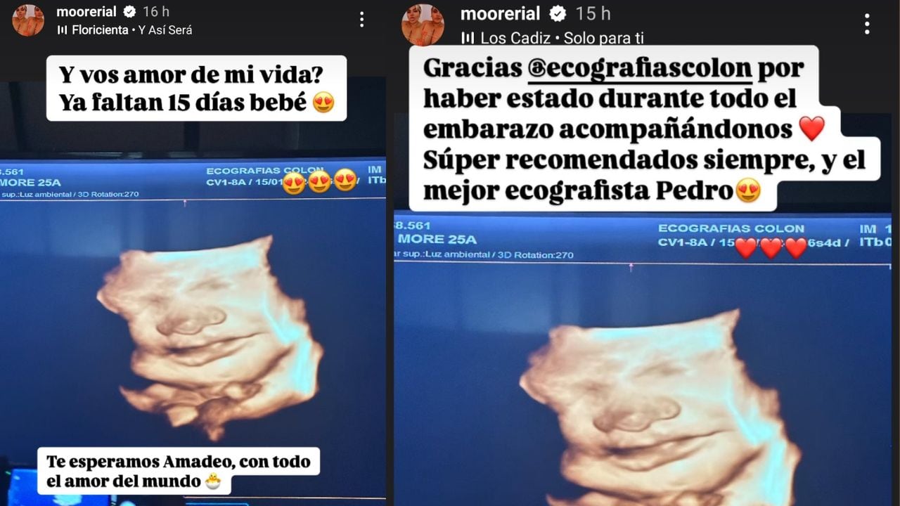 Morena Rial compartió una ecografía de su bebé / Instagram @moorerial