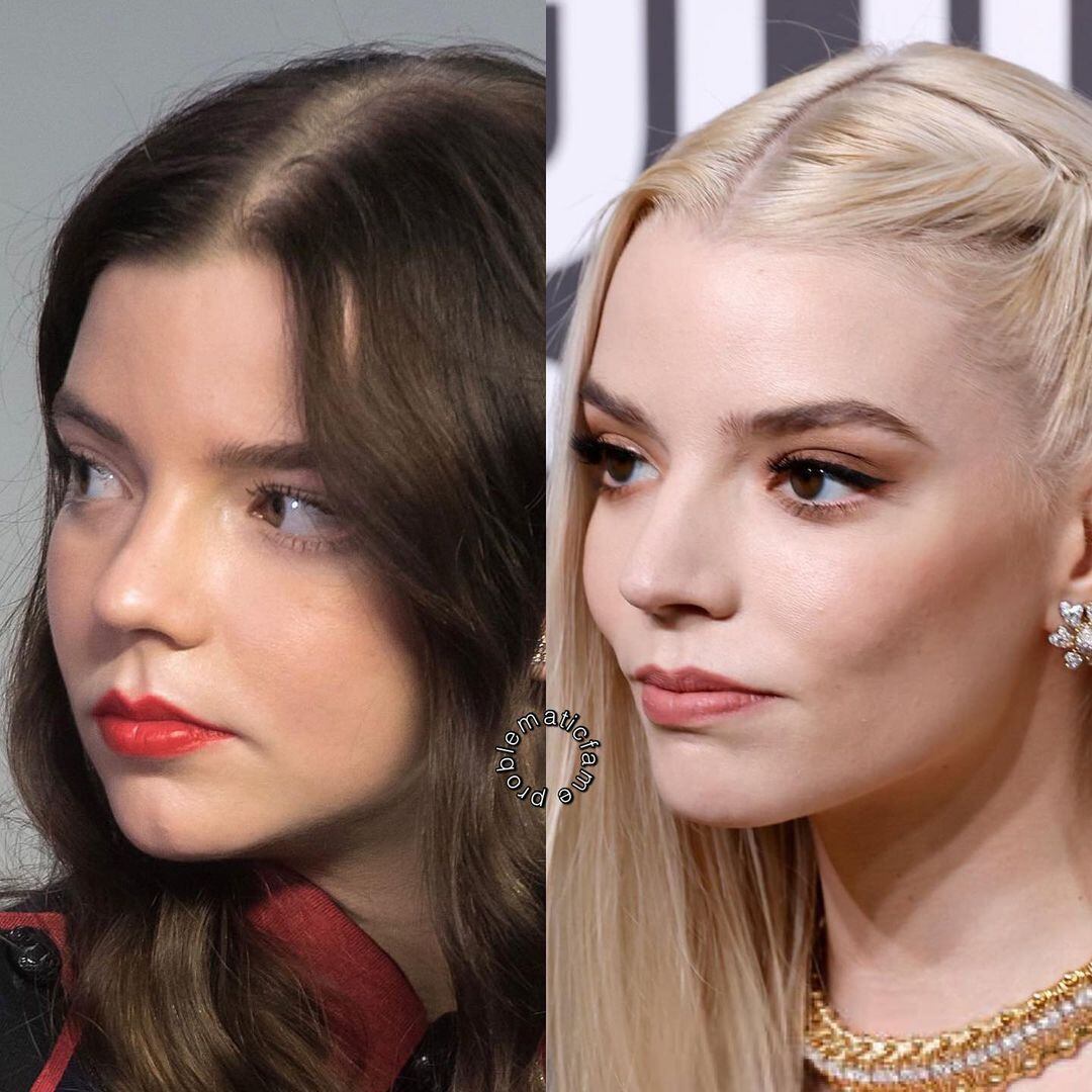 El antes y después de Anya Taylor-Joy