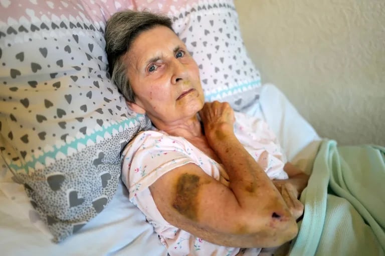 Una anciana postrada en una cama sufrió en brutal ataque de una enorme rata.