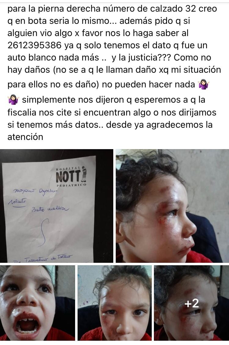 Piden ayuda para Angelina, una nena de 7 años que fue atropellada en Guaymallén.