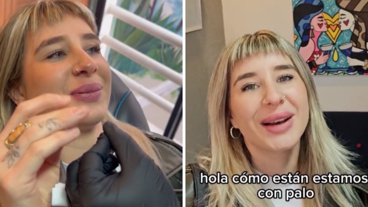 Paloma de Gran Hermano compartió un video TikTok donde mostró lo que tenía en los labios