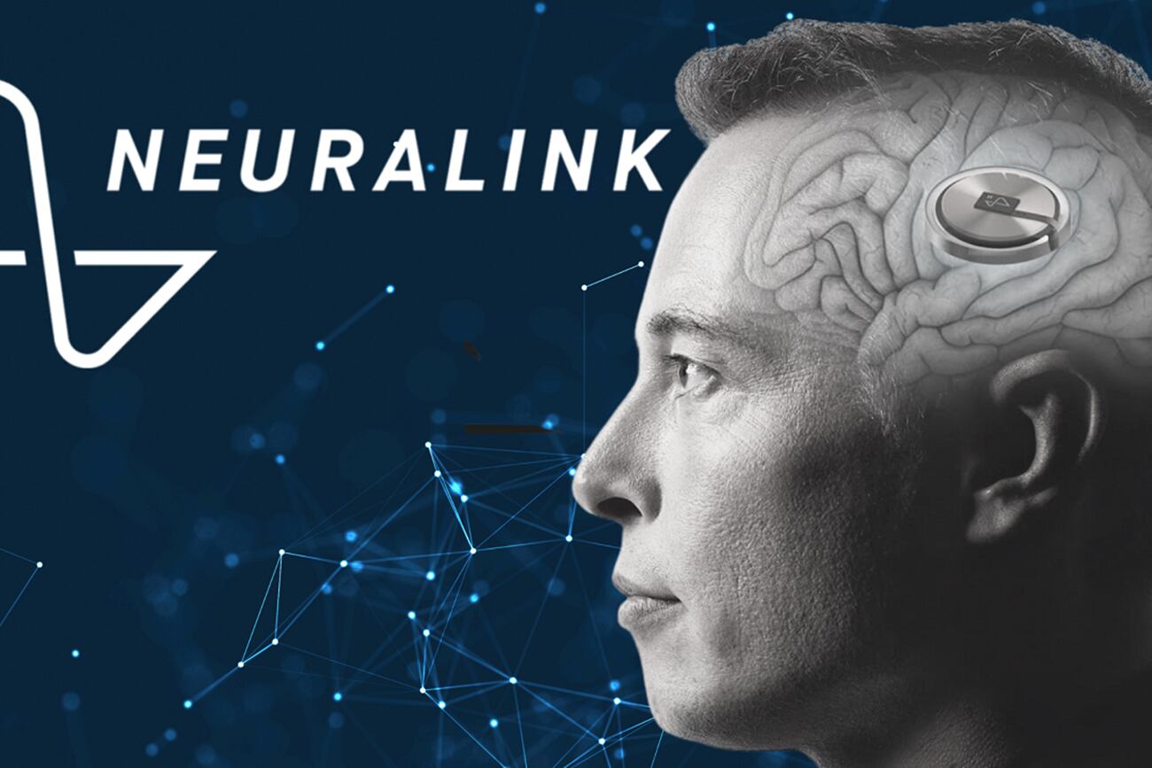 Elon Musk confirmó que Neuralink implantó un chip cerebral en un ser humano por primera vez. (Neuralink)