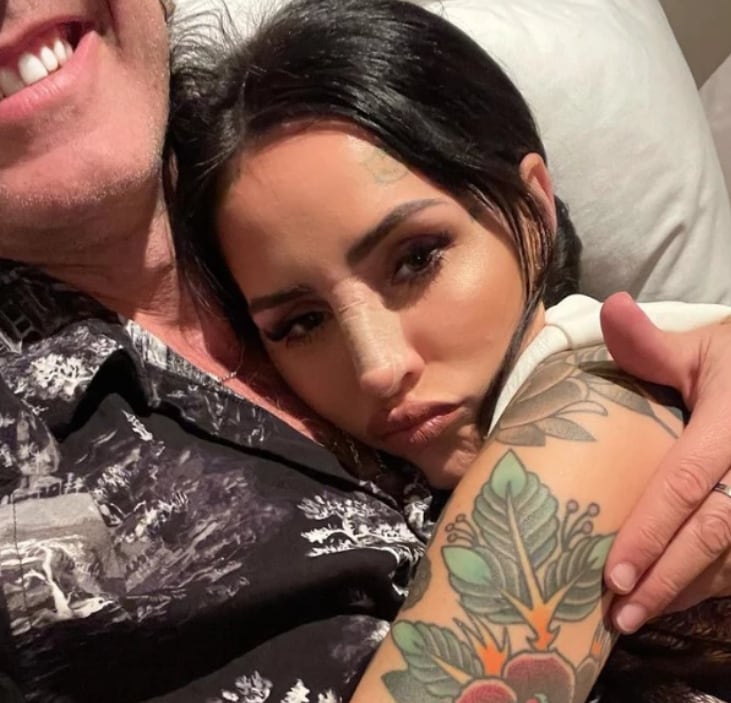 Cande Tinelli, tras su cirugía estética.