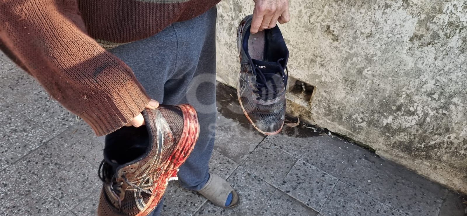 Las zapatillas de uno de los heridos tras el ataque del pitbull. Foto: Cadena 3