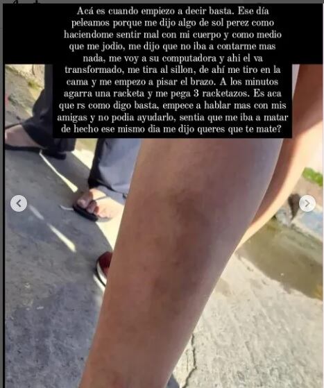 En otros actos de violencia le pegó en la pierna con una raqueta de tenis.