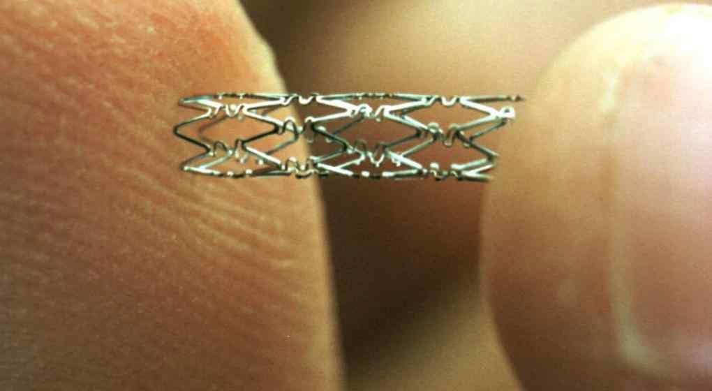 Los cardiangiólogos son los médicos que colocan los stents, un gran invento argentino.