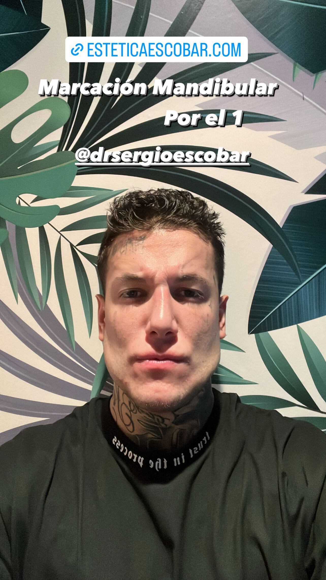 Alex Caniggia se hizo un retoque estético en el rostro y ya no parece él