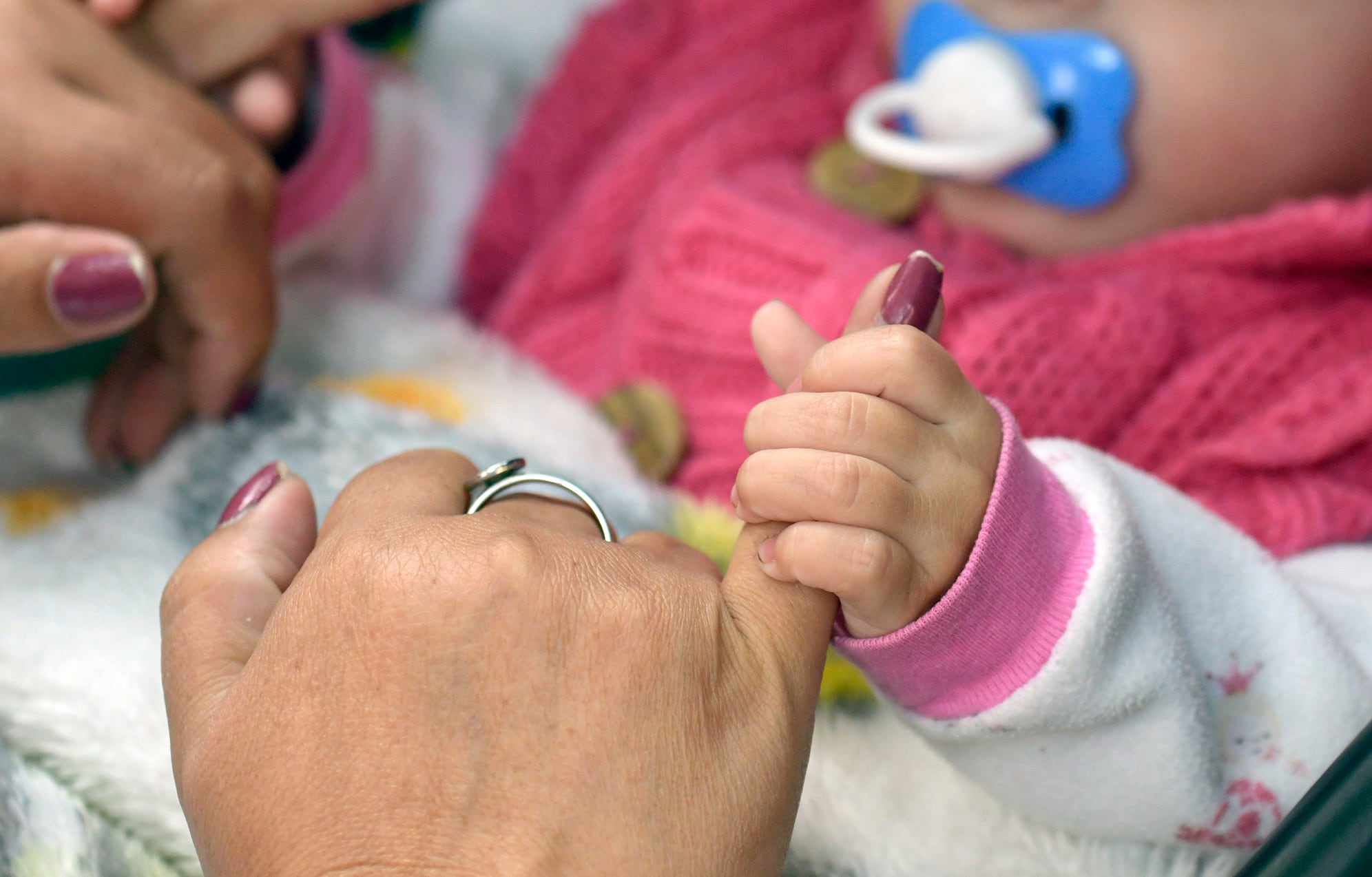 La pequeña Lupita ya fue sometida a 11 cirugías en su corta vida. Foto: Orlando Pelichotti / Los Andes