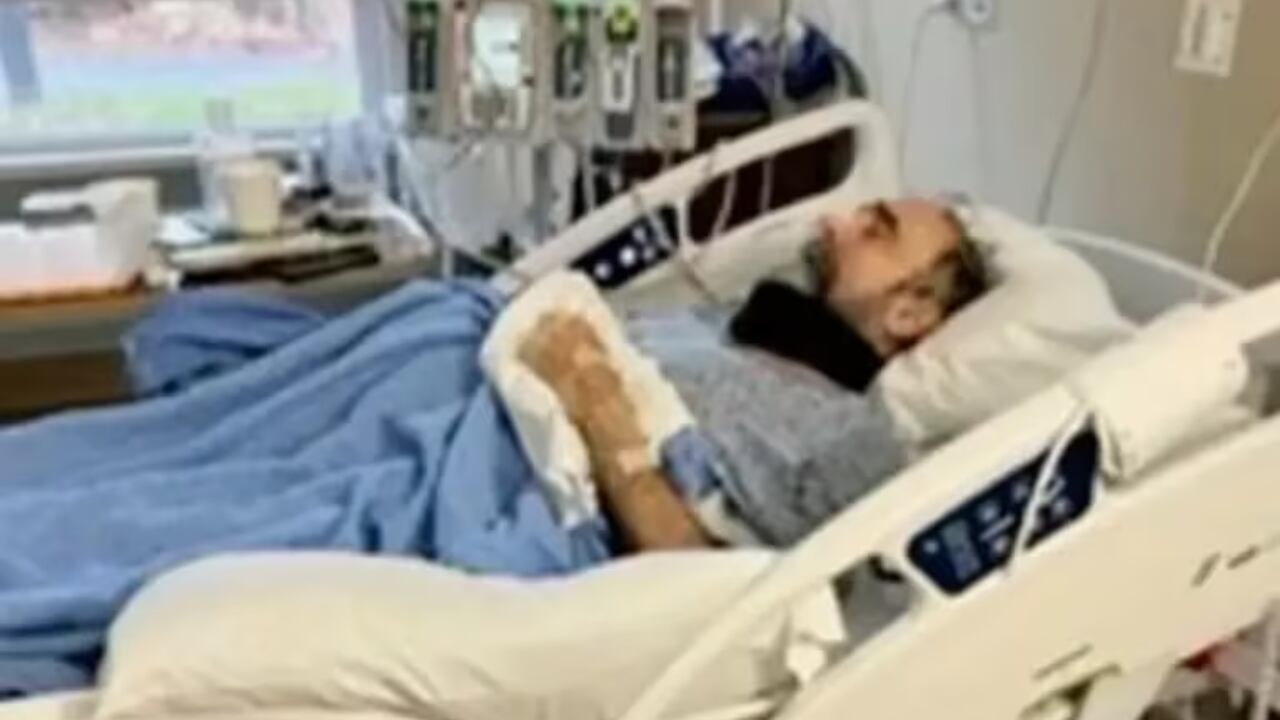 Durante la recuperación, George perdió 18 kilos y sufrió de un intenso dolor. Gentileza: New York Post.