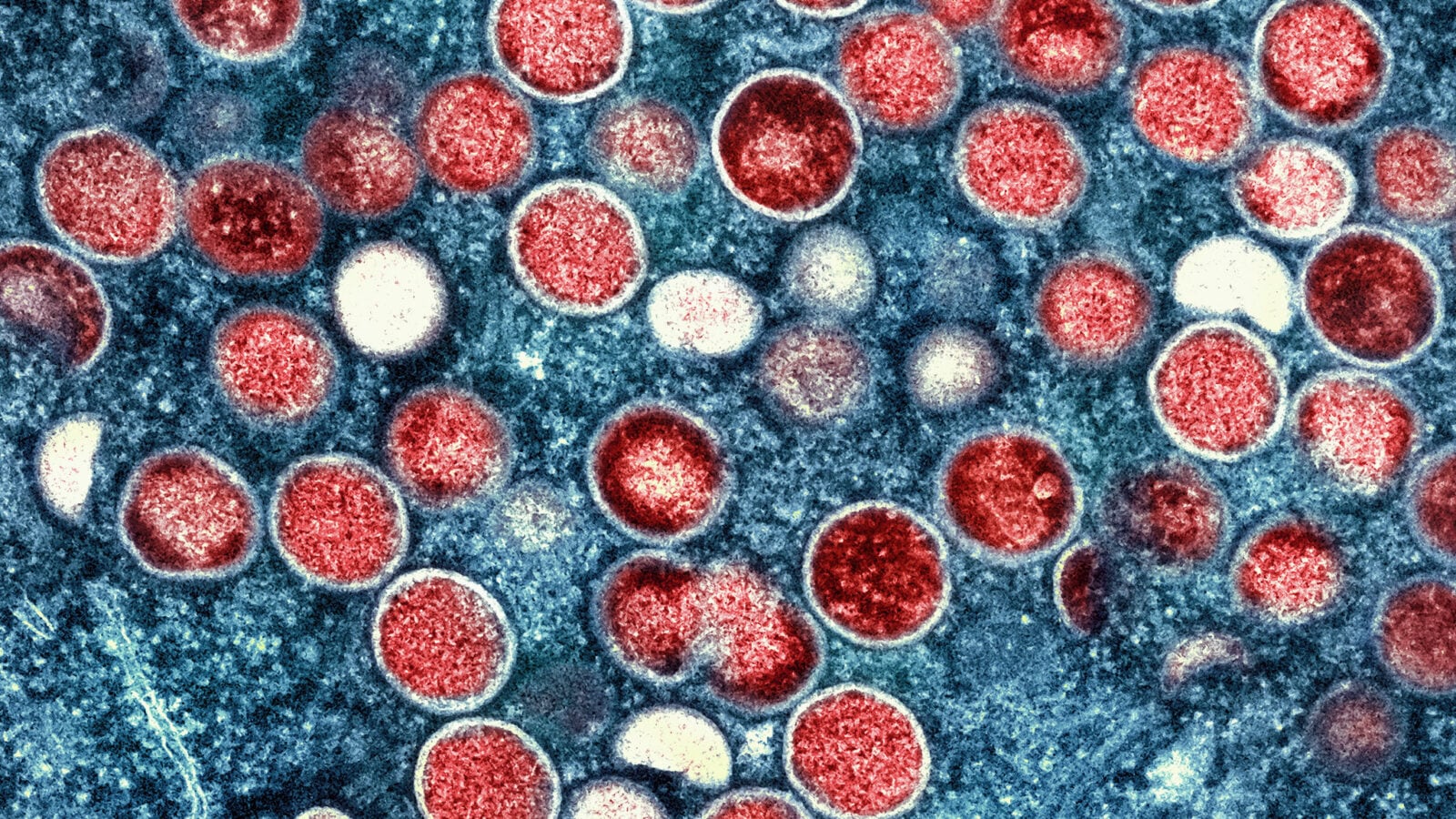 Virus. Se secuenciaron varias muestras de viruela del mono para determinar el origen del brote. (Instituto de Enfermedades Infecciosas y Alergias de EE.UU.)