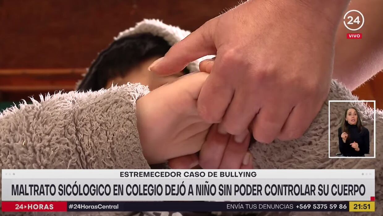 La historia del nene que sufre bullying y fuertes dolores en su cuerpo (24 Horas)