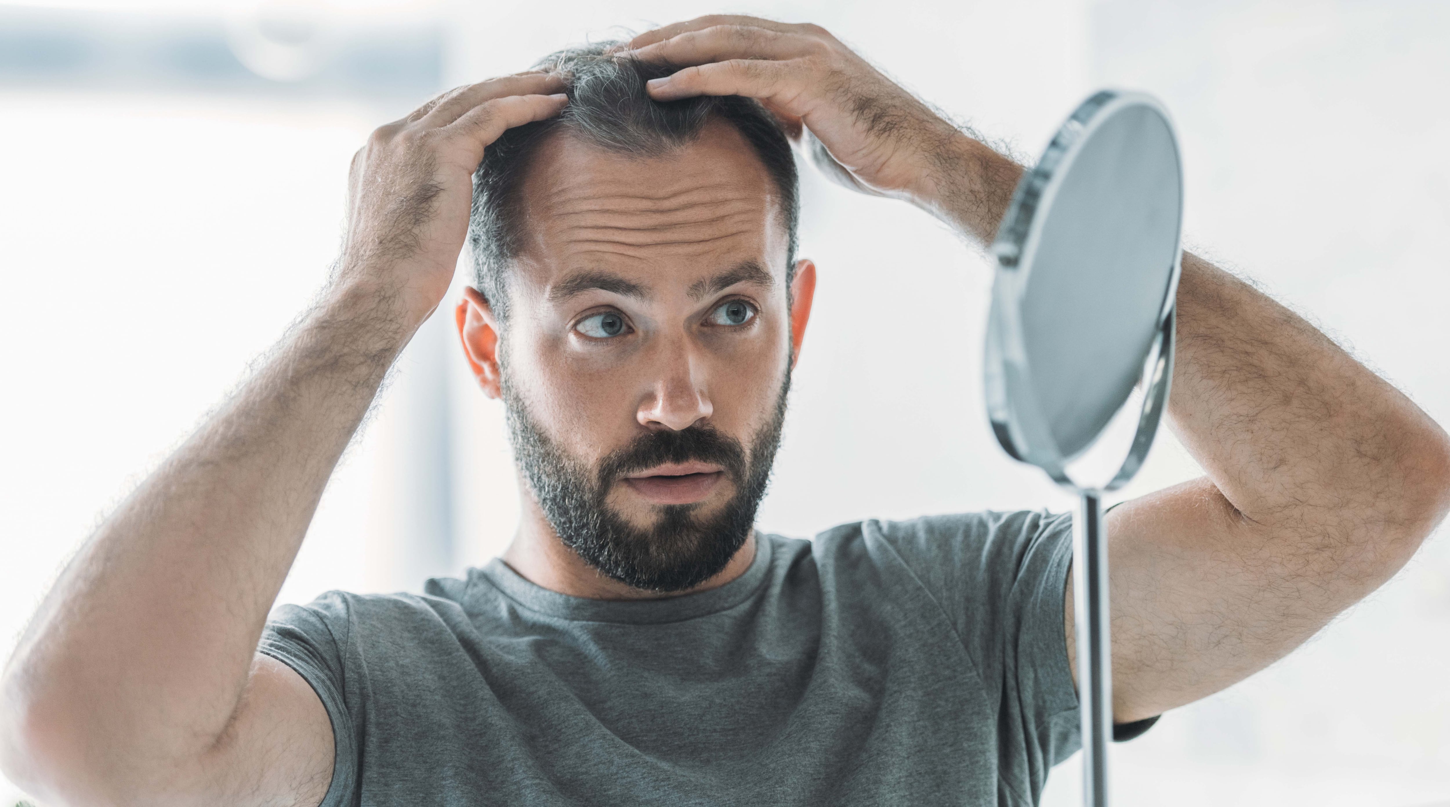 El diagnóstico de la alopecia androgenética generalmente se basa en la evaluación de un dermatólogo.