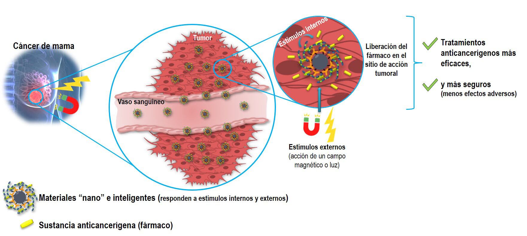 Medicina. Materiales "nano" e inteligentes para terapias contra el cáncer de mama.