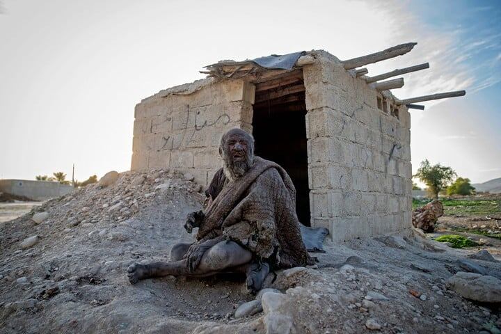 Un iraní vivió hasta los 94 años y pasó más de 6 décadas sin higienizarse.