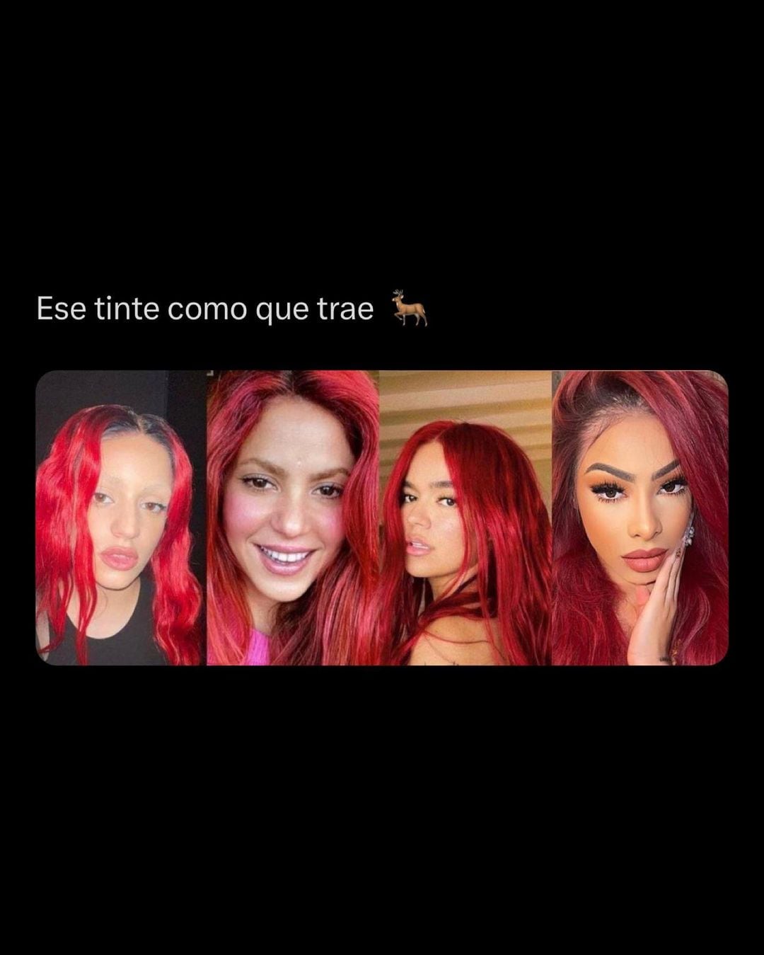 La coincidencia de Shakira, Rosalía, Karol G en el color de pelo.