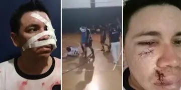 Fútbol amateur de Corrientes: le pegó un cabezazo a un rival y lo dejó inconsciente